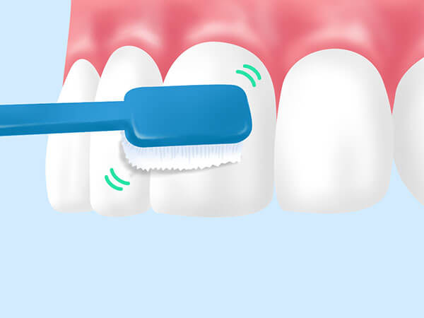 ブラッシング指導：患者さまごとに適切な歯磨きの方法をアドバイスいたします。